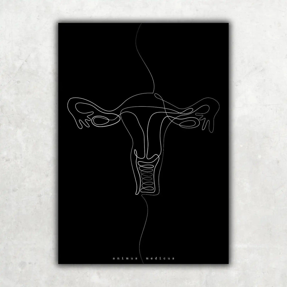 Uterus Anatomie Minimalist Dark - Animus Medicus GmbH