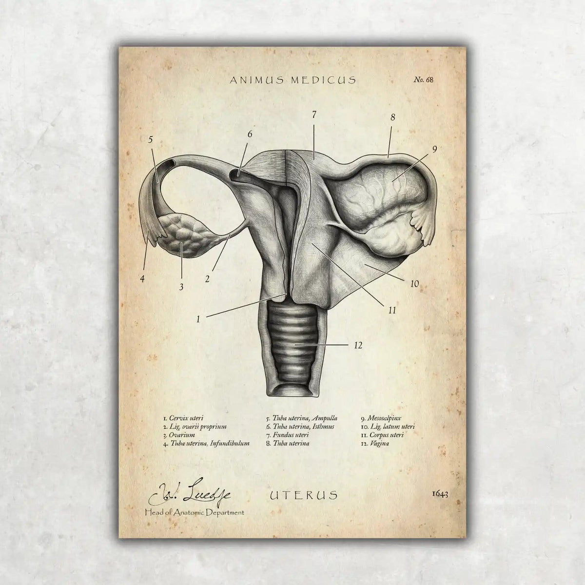 Uterus mit Adnexe - Animus Medicus GmbH