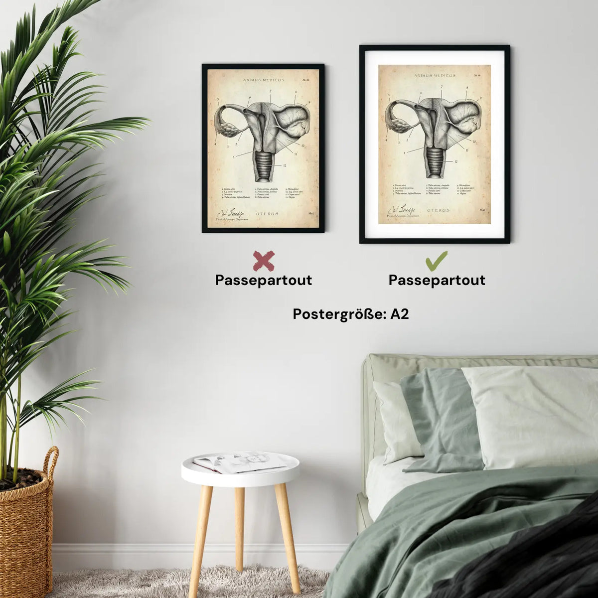 Uterus mit Adnexe - Animus Medicus GmbH