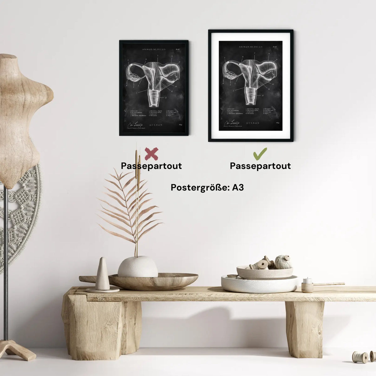 Uterus mit Adnexe - Chalkboard - Animus Medicus GmbH