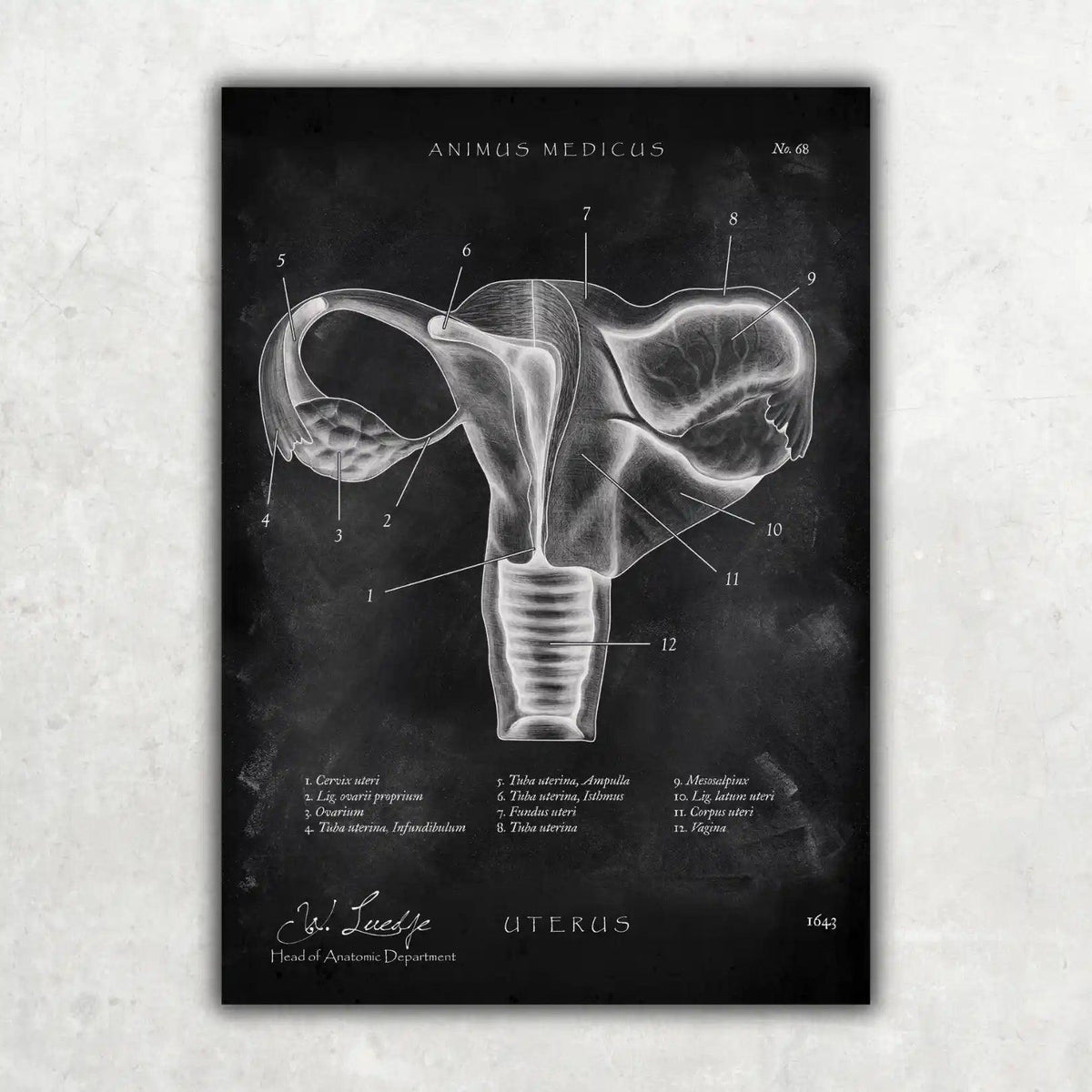 Uterus mit Adnexe - Chalkboard - Animus Medicus GmbH