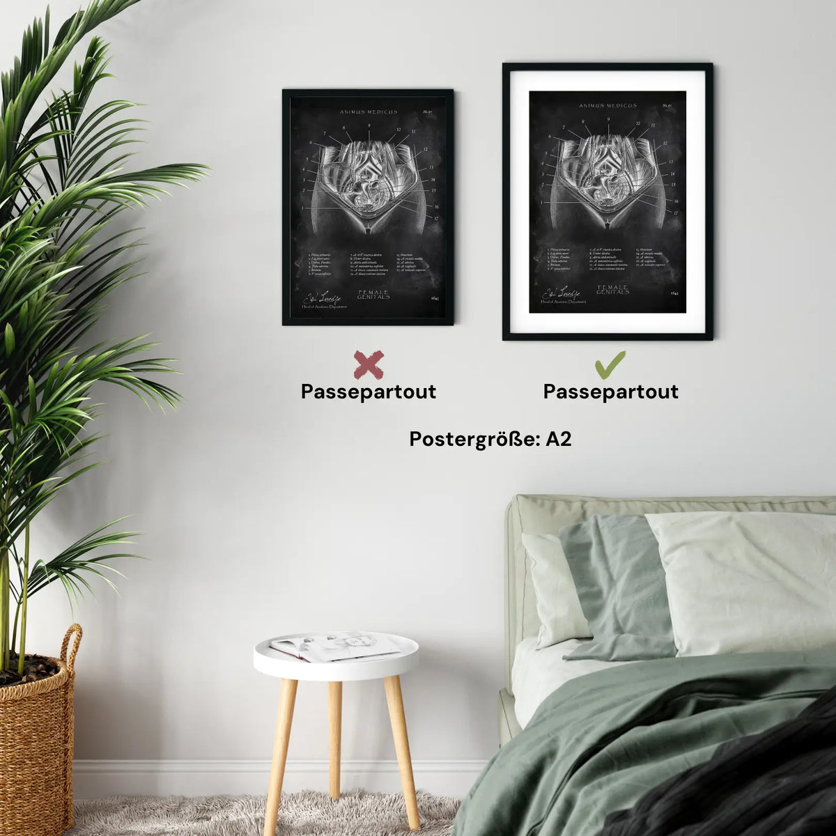 Weibliche Genitalien - Chalkboard - Animus Medicus GmbH