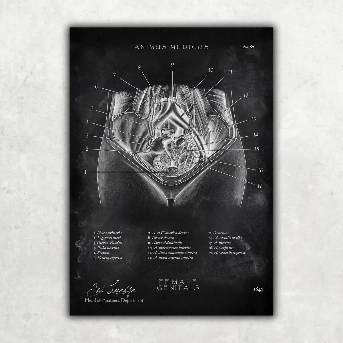 Weibliche Genitalien - Chalkboard - Animus Medicus GmbH