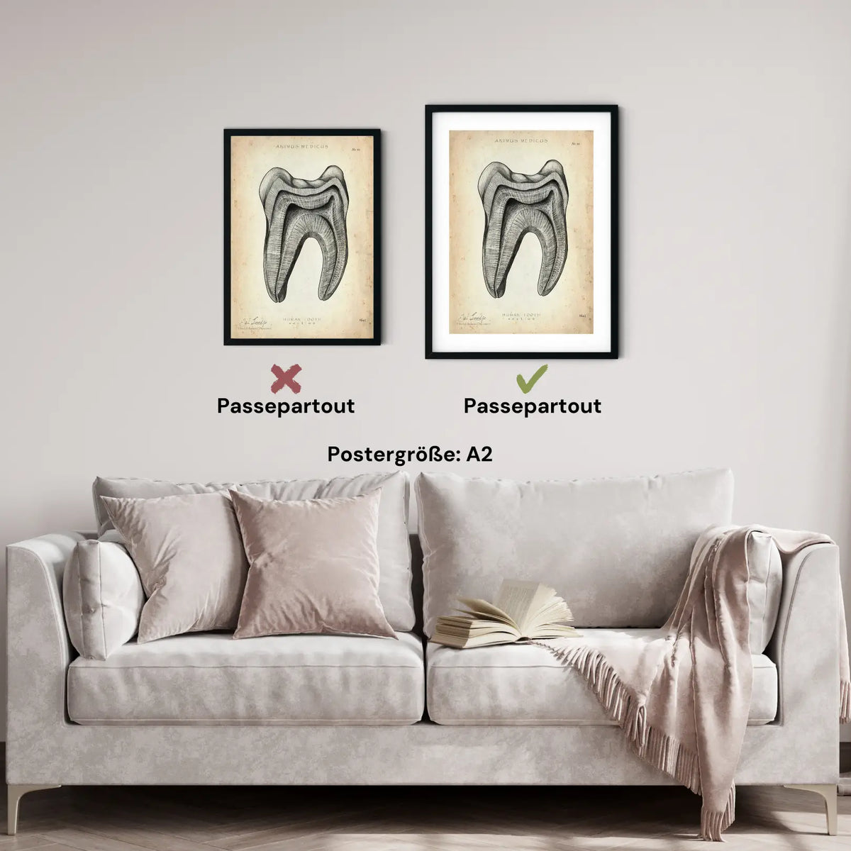 Zahn Anatomie im Querschnitt - Animus Medicus GmbH