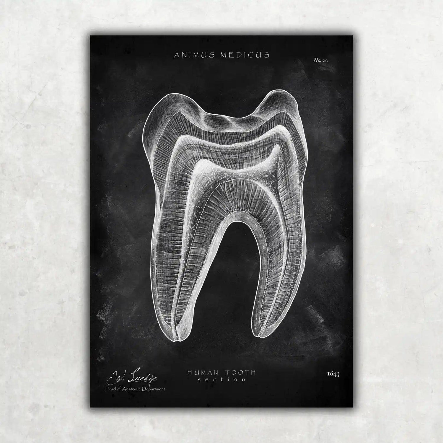 Zahn Anatomie im Querschnitt - Chalkboard - Animus Medicus GmbH