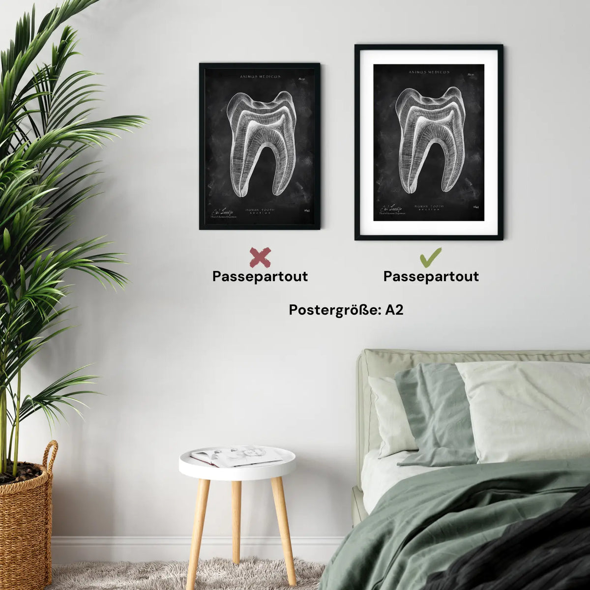 Zahn Anatomie im Querschnitt - Chalkboard - Animus Medicus GmbH