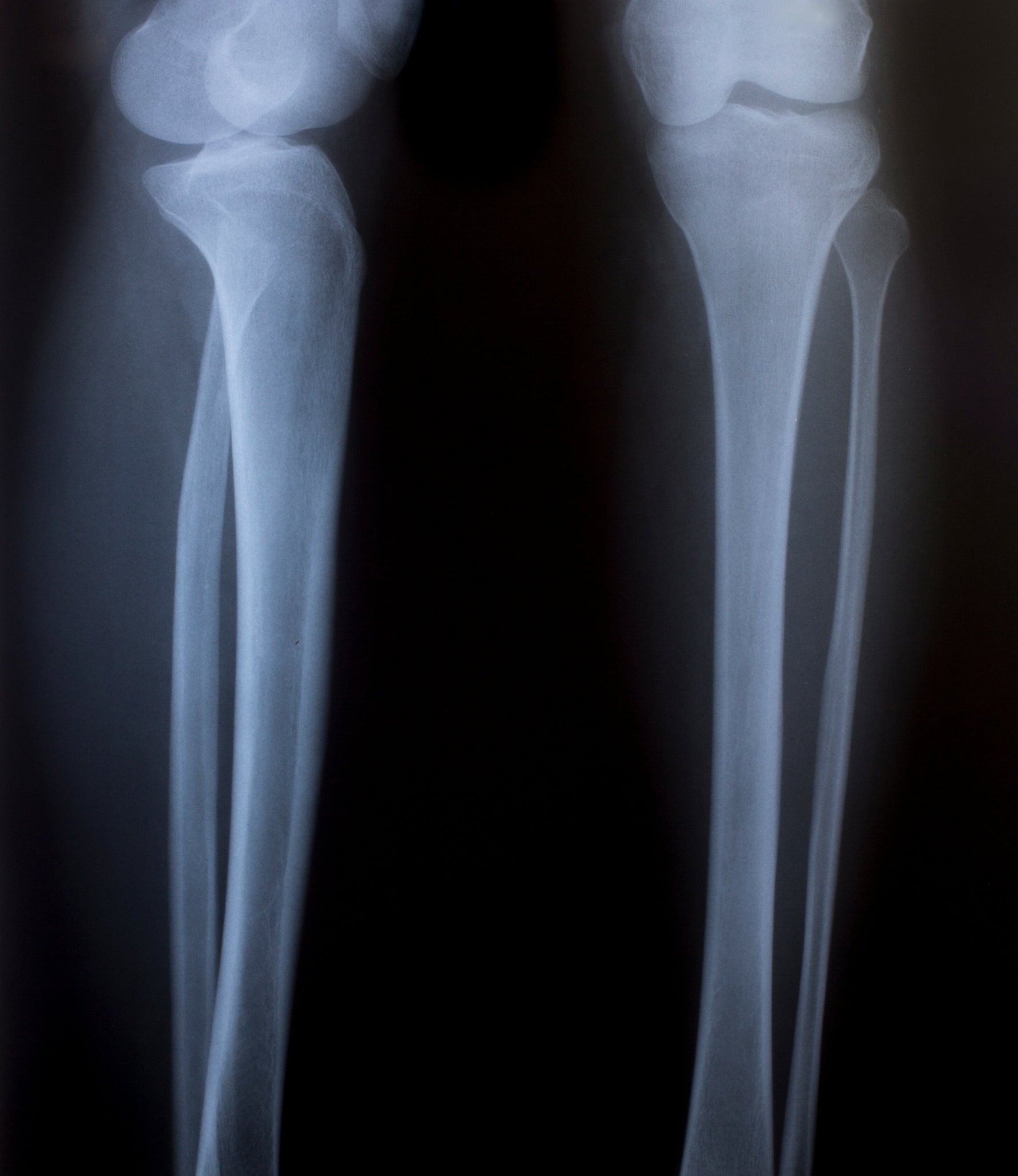 Der größte menschliche Knochen: Spannende Fakten - Animus Medicus