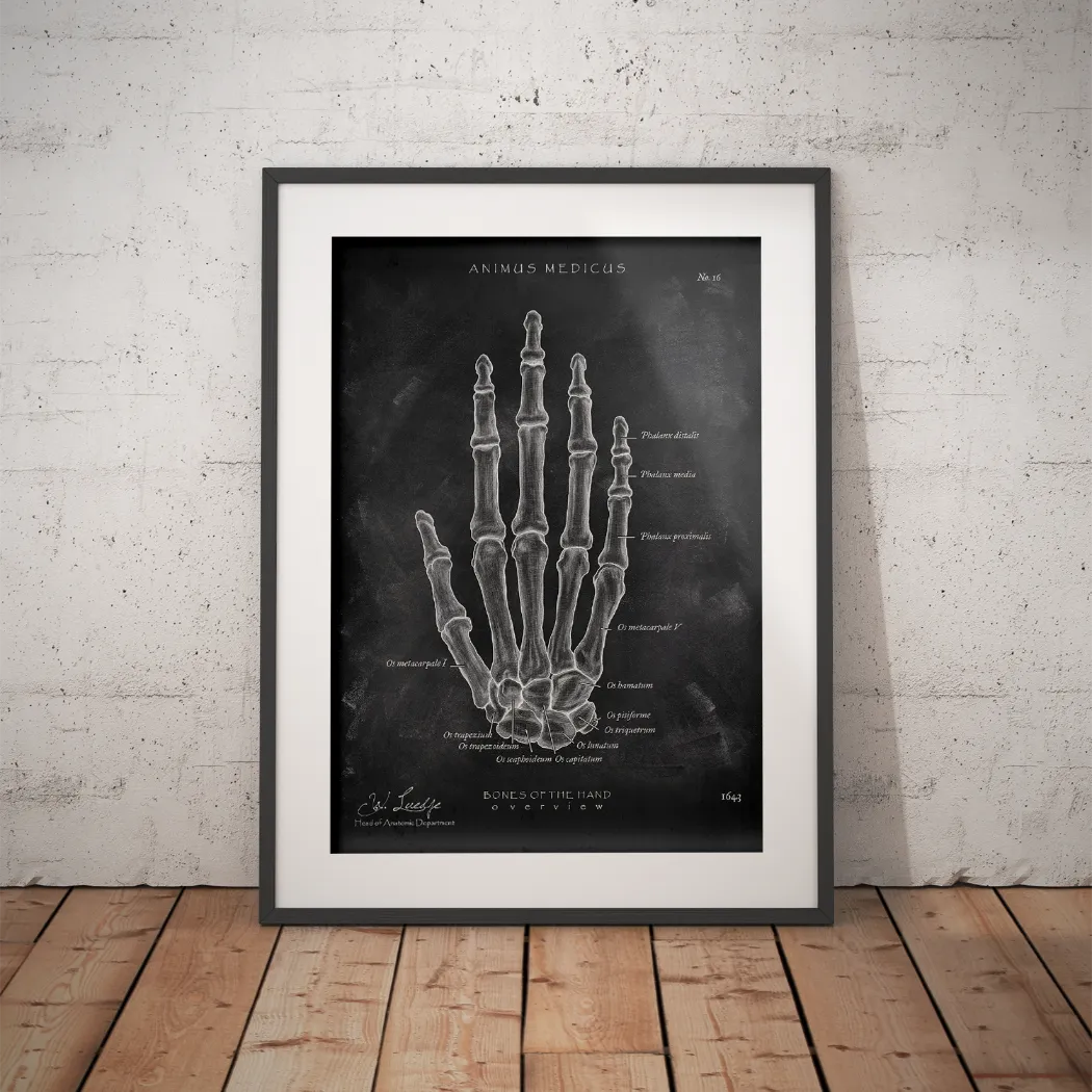 Hand Bones Anatomy - Chalkboard