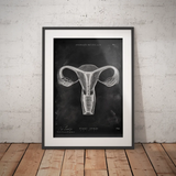 Uterus Anatomie - Chalkboard