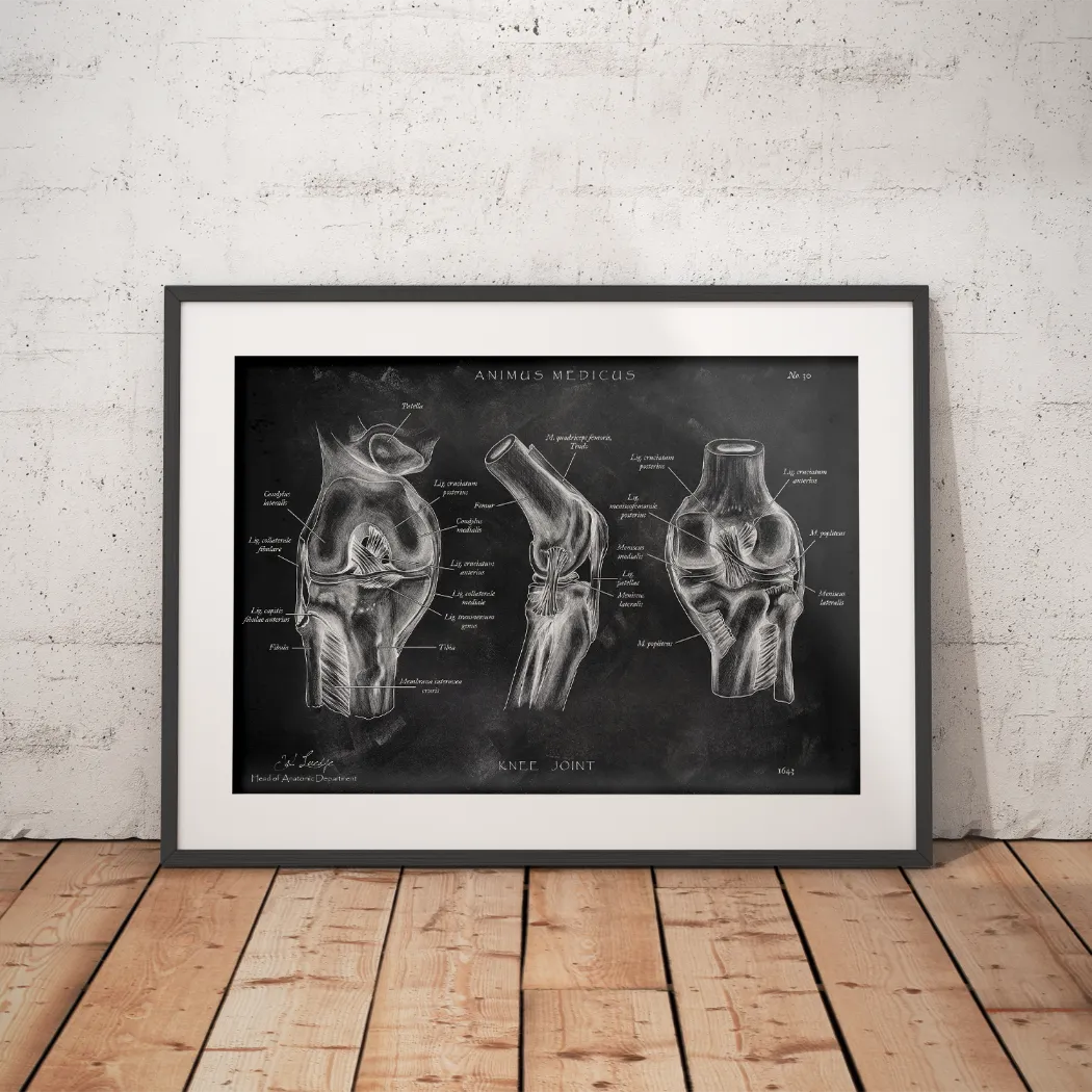 Knee Joint Anatomy - Chalkboard