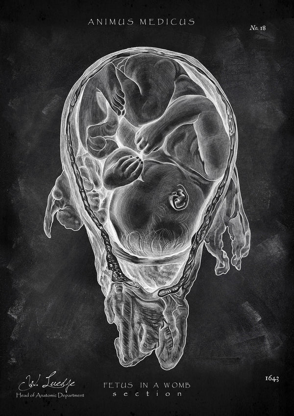 Baby in Gebärmutter - Chalkboard