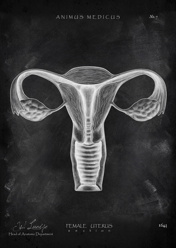 Uterus Anatomie - Chalkboard