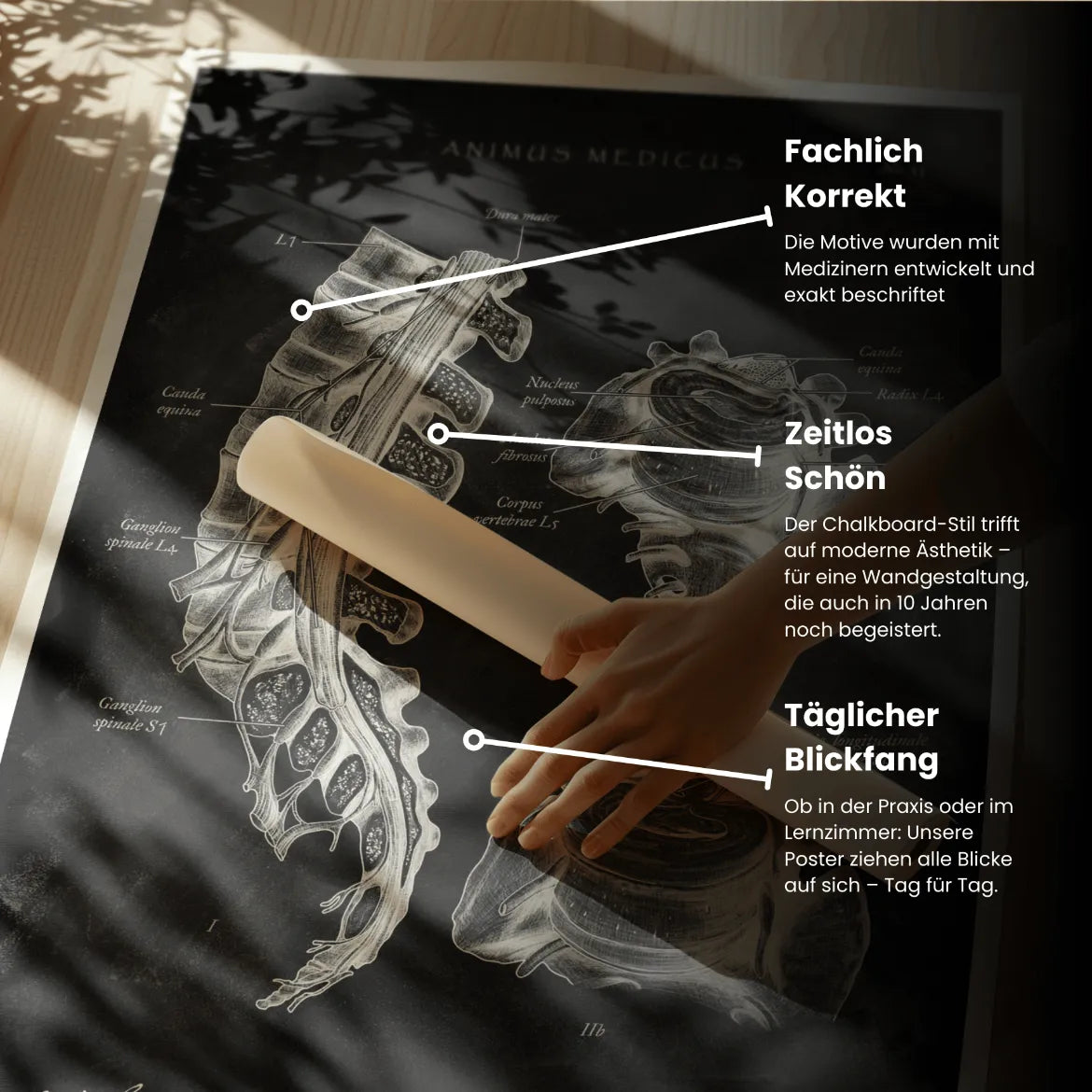 Bandscheibenvorfall Anatomie - Chalkboard