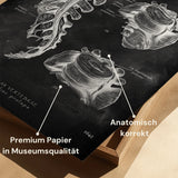 Herniated Disc Anatomy - Chalkboard