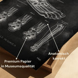 Sprunggelenk mit Bänderriss - Chalkboard