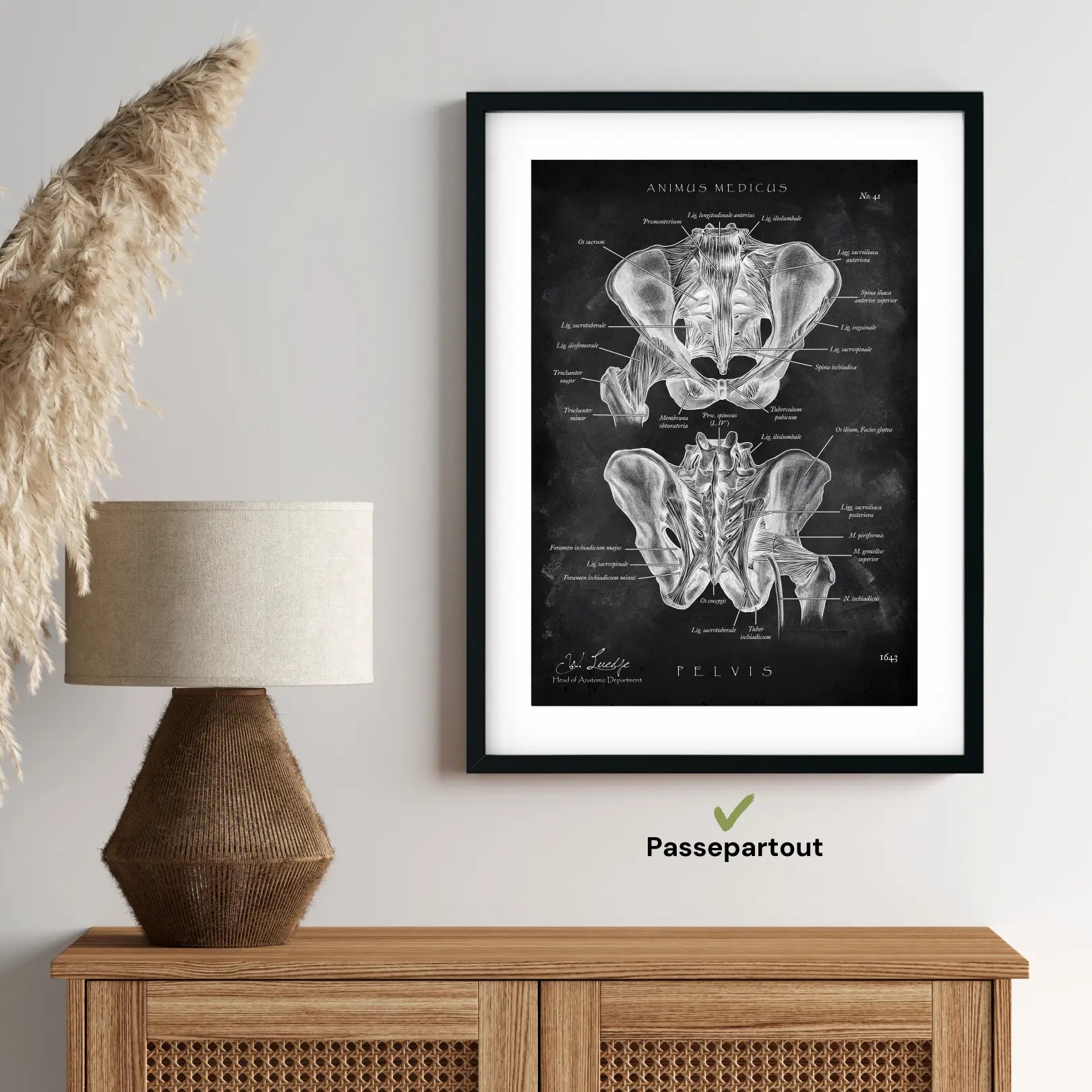 Hip Joint Anatomy - Chalkboard