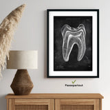 Zahn Anatomie im Querschnitt - Chalkboard