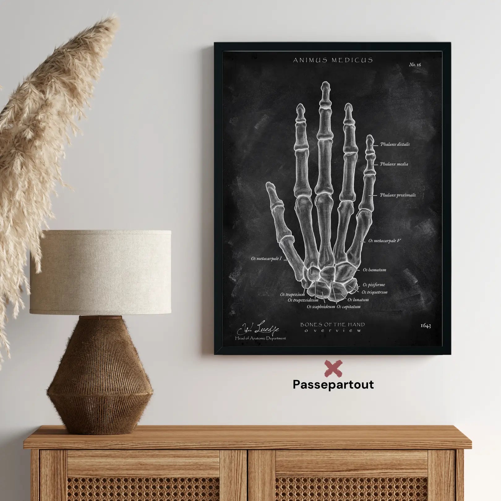 Hand Bones Anatomy - Chalkboard