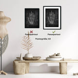 Handknochen Anatomie - Chalkboard