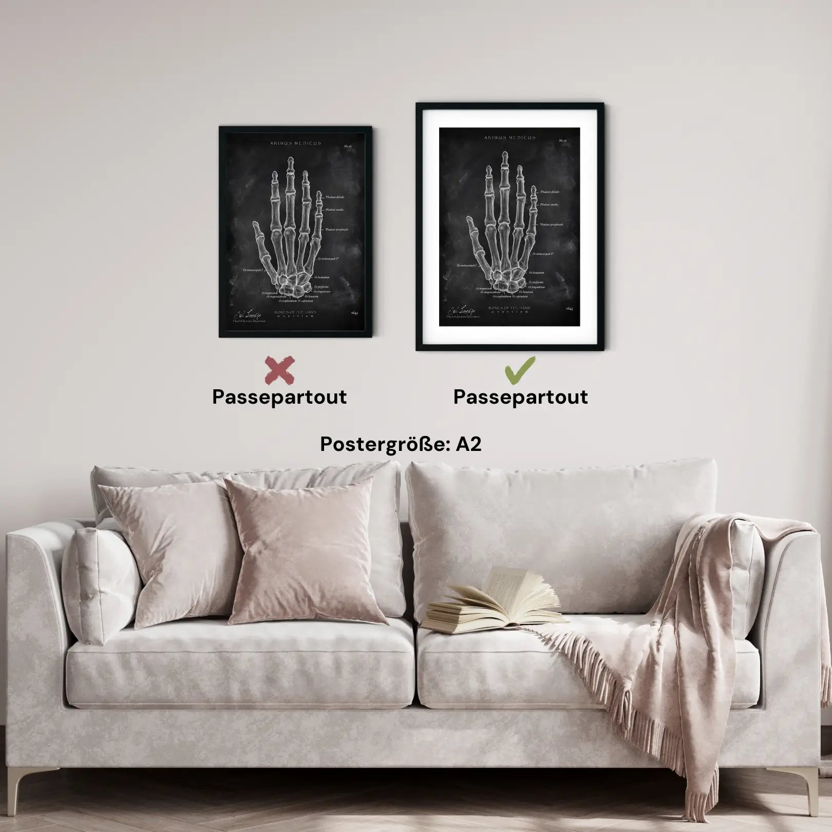 Hand Bones Anatomy - Chalkboard