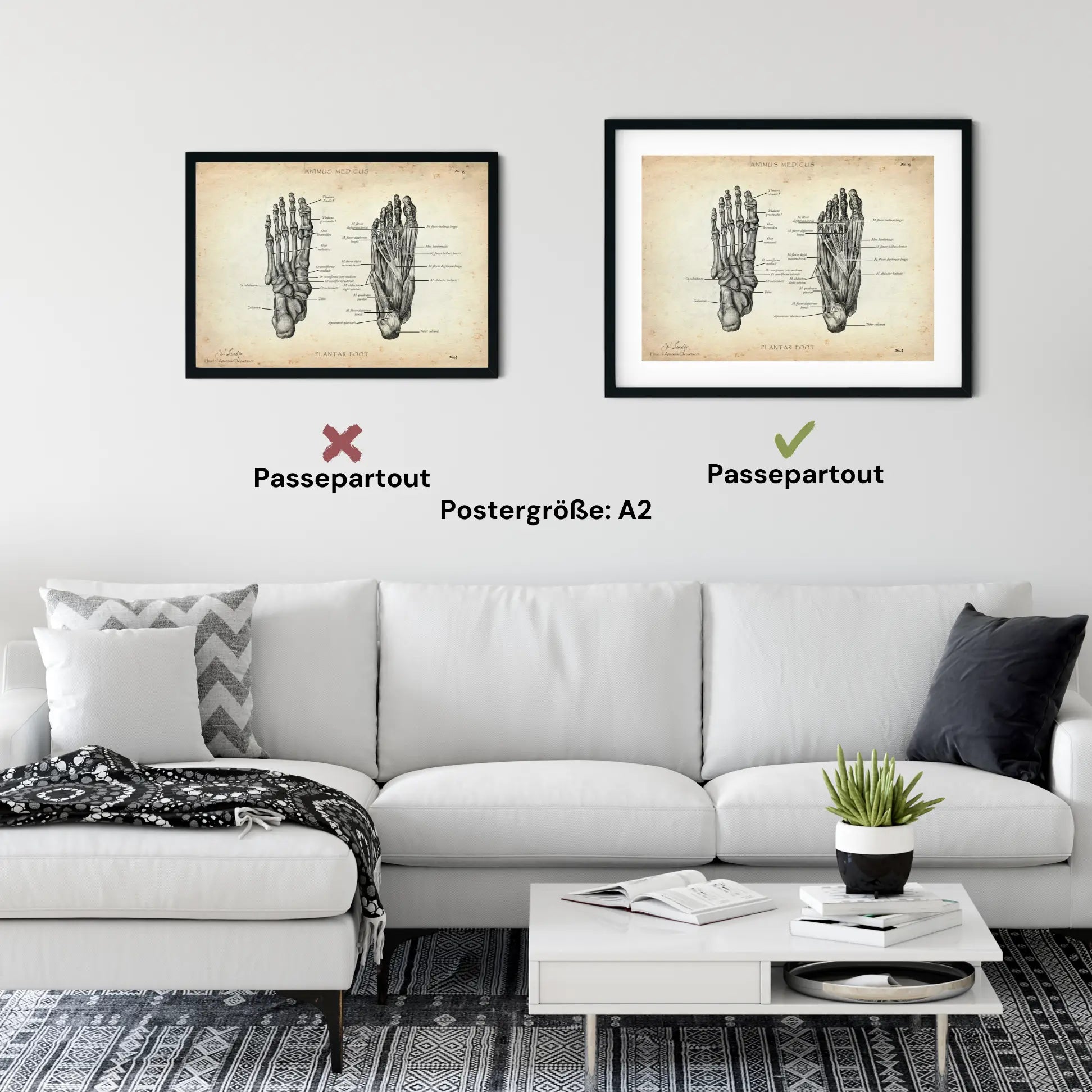 Foot Anatomy | bones and muscles