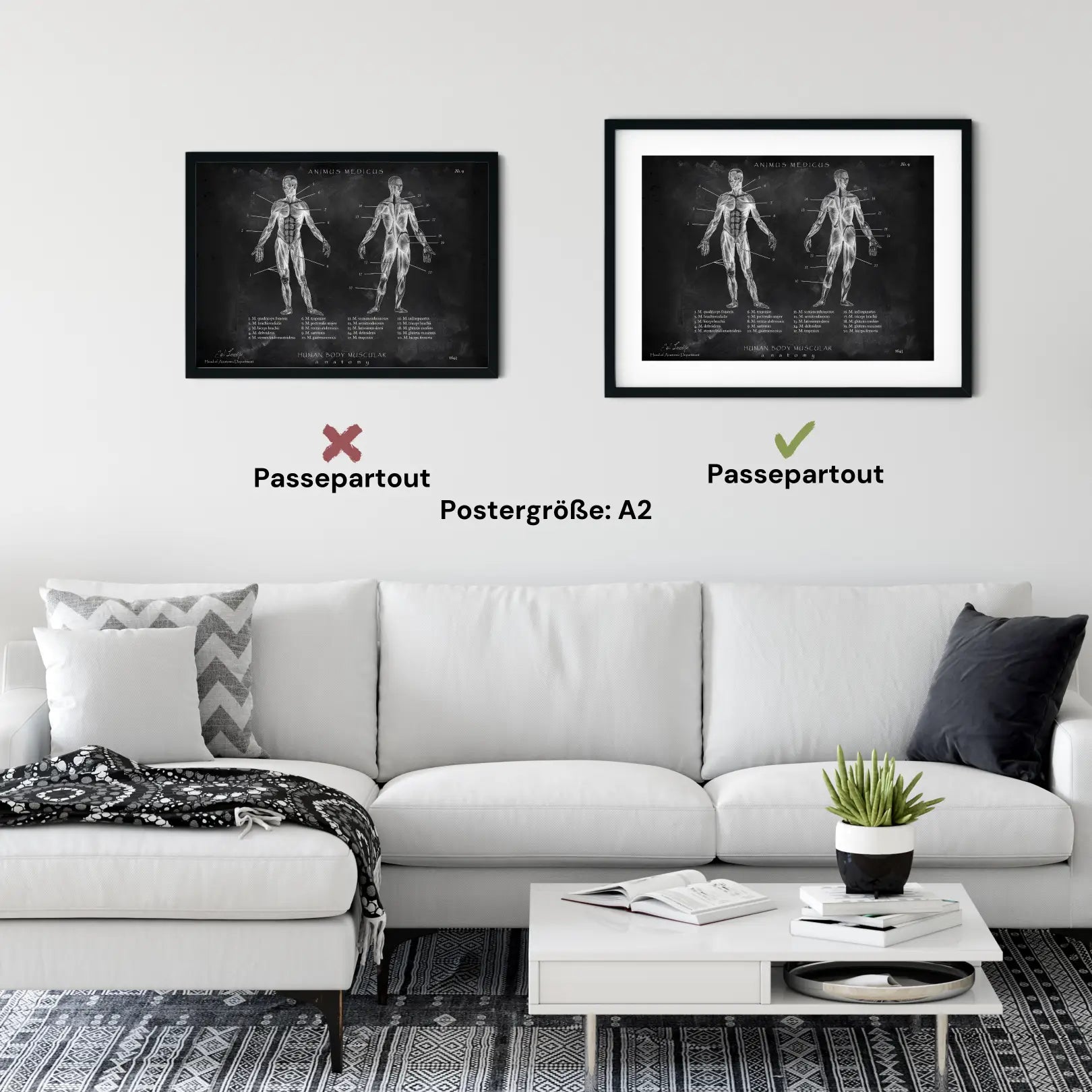 Muskeln Anatomie - Chalkboard