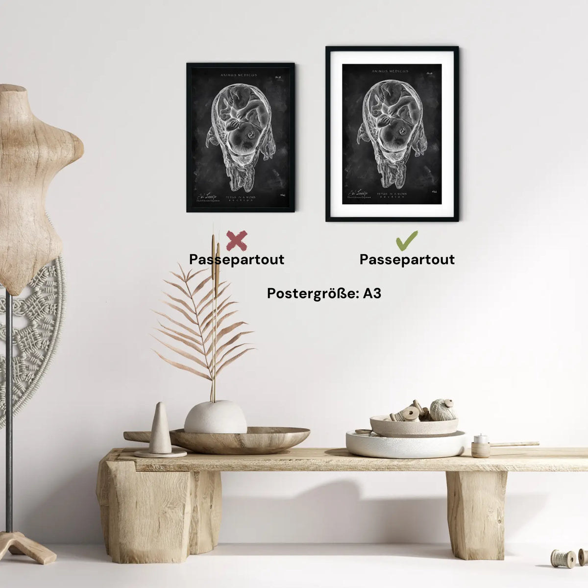 Baby in Gebärmutter - Chalkboard - Animus Medicus GmbH