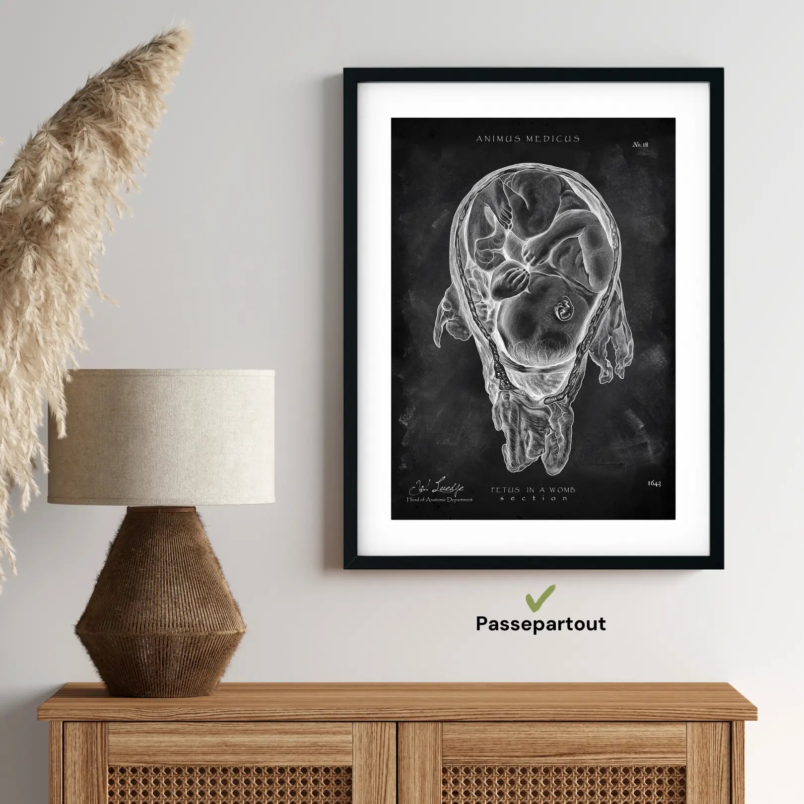 Baby in Gebärmutter - Chalkboard - Animus Medicus GmbH