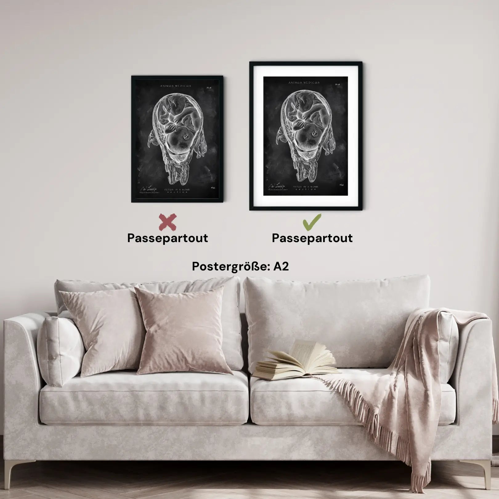 Baby in Gebärmutter - Chalkboard - Animus Medicus GmbH