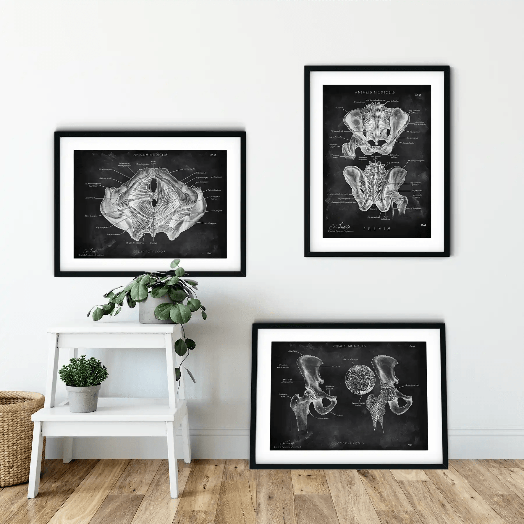 Becken Anatomie Sammlung - Chalkboard - Animus Medicus GmbH