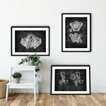 Becken Anatomie Sammlung - Chalkboard - Animus Medicus GmbH
