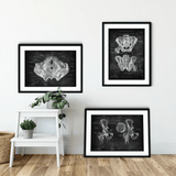 Becken Anatomie Sammlung - Chalkboard - Animus Medicus GmbH