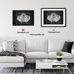 Beckenboden Muskulatur - Chalkboard - Animus Medicus GmbH
