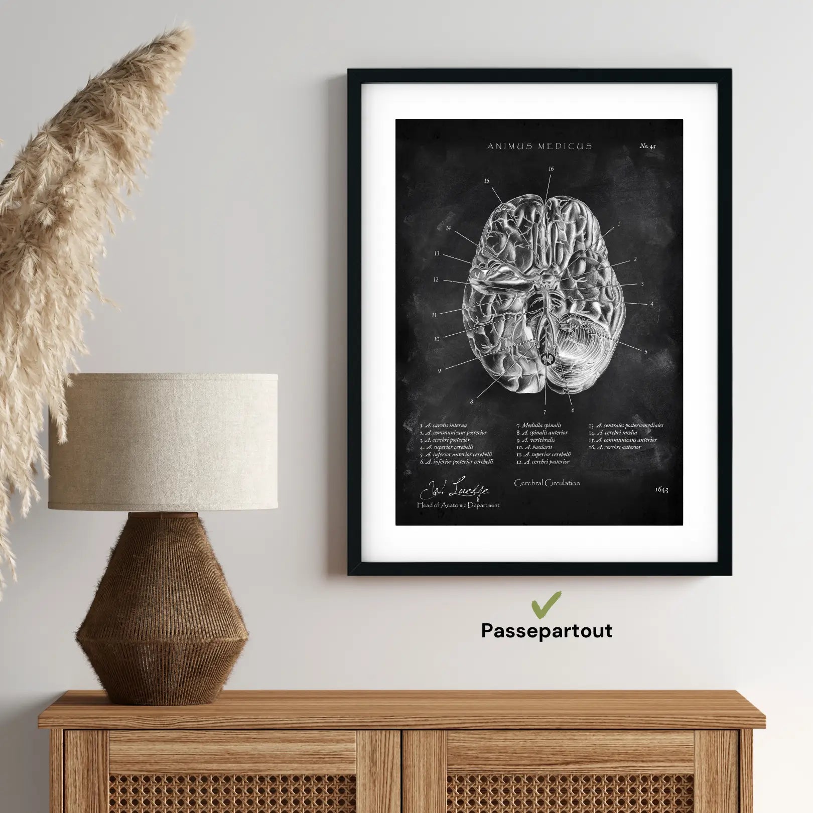Circulus arteriosus willisii - Chalkboard - Animus Medicus GmbH