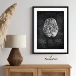 Circulus arteriosus willisii - Chalkboard - Animus Medicus GmbH