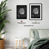 Circulus arteriosus willisii - Chalkboard - Animus Medicus GmbH