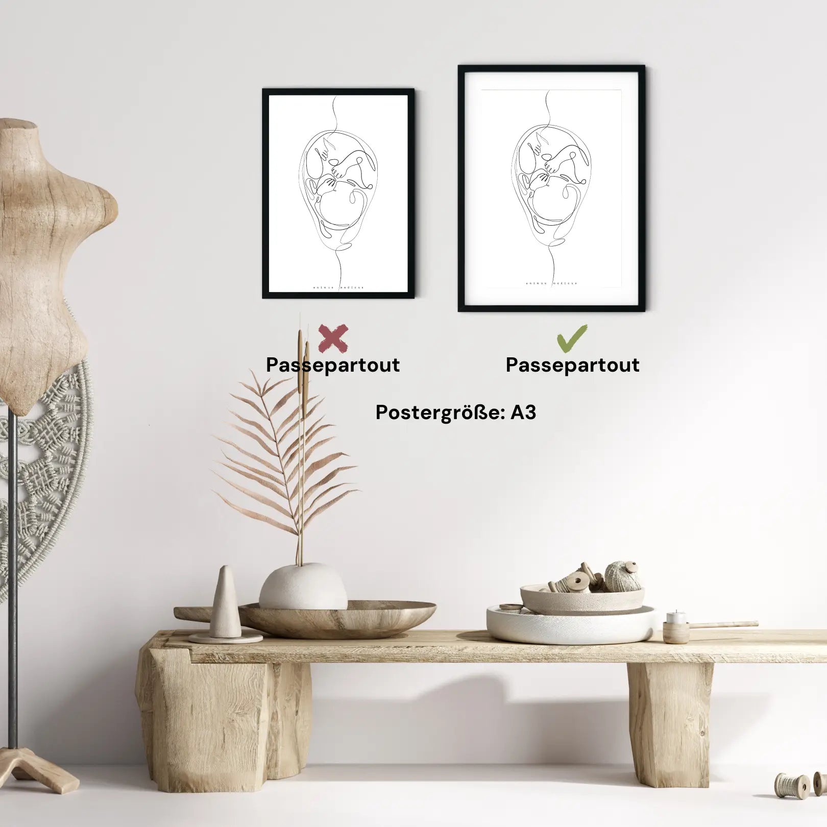 Fetus Anatomie Minimalist - Animus Medicus GmbH