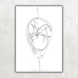 Fetus Anatomie Minimalist - Animus Medicus GmbH
