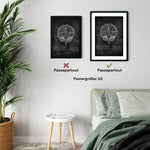 Gehirn Aufbau im Schnitt - Chalkboard - Animus Medicus GmbH