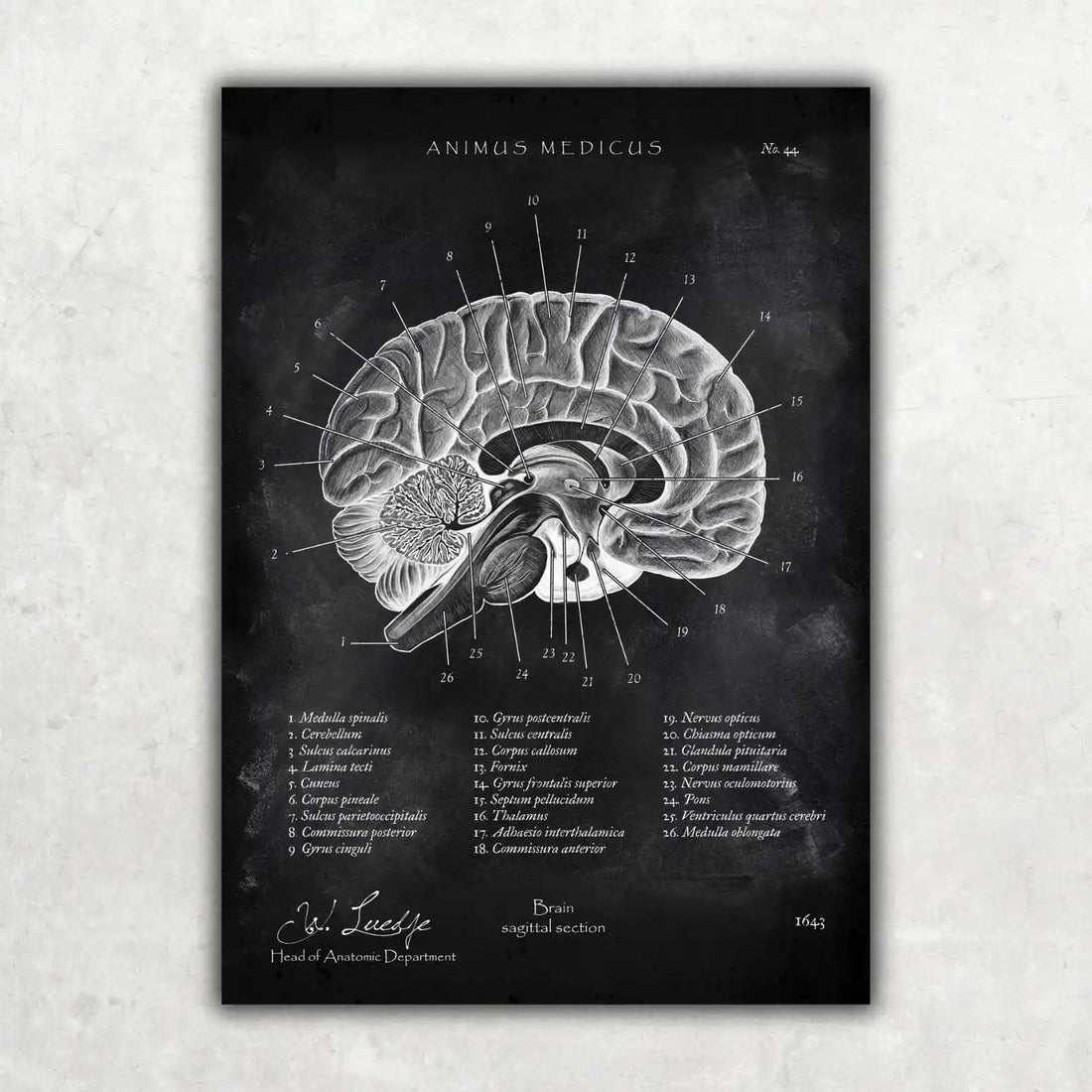 Gehirn im Sagittalschnitt - Chalkboard - Animus Medicus GmbH