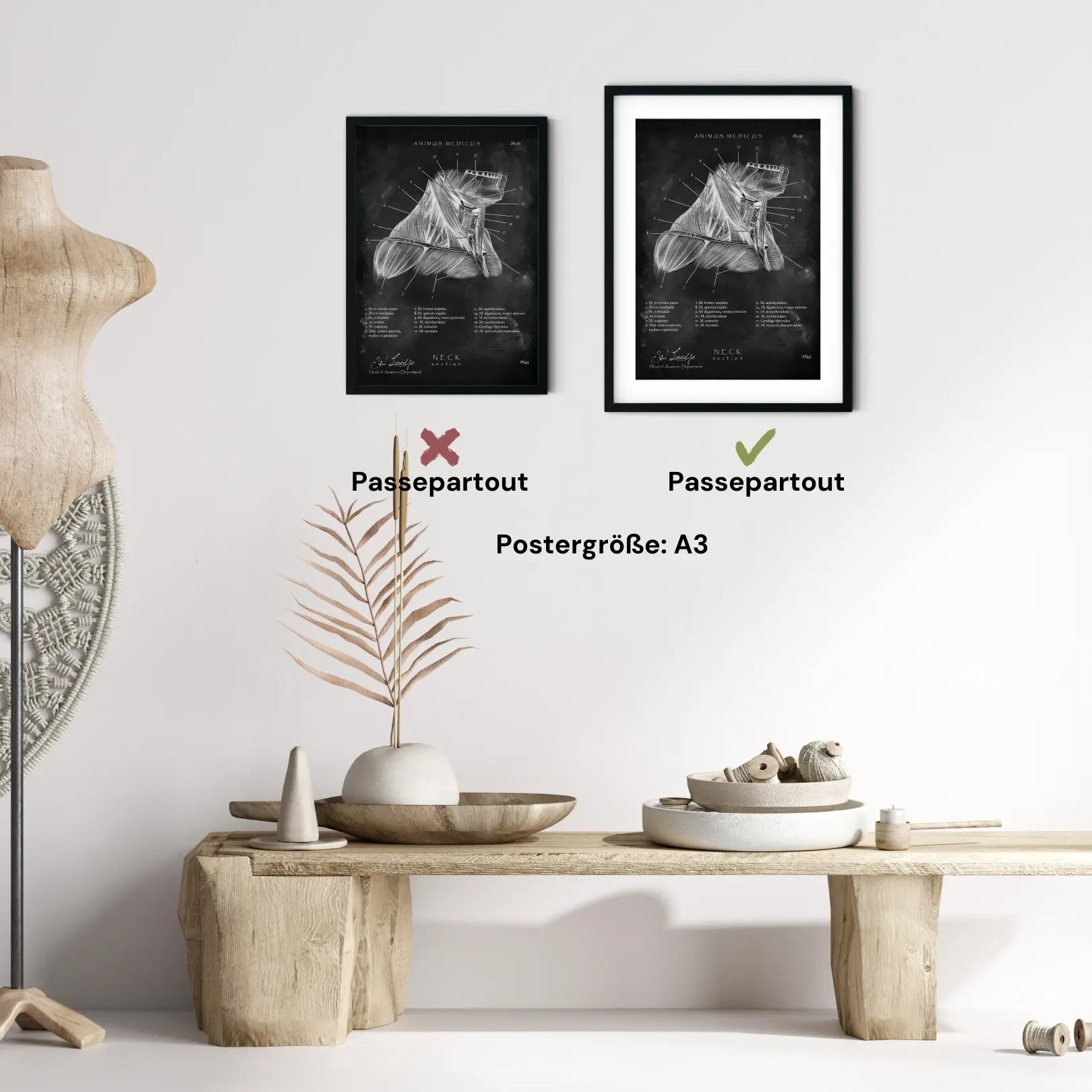 Halsmuskeln im Schnitt - Chalkboard - Animus Medicus GmbH