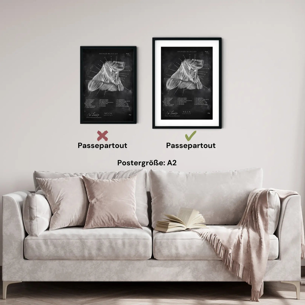 Halsmuskeln im Schnitt - Chalkboard - Animus Medicus GmbH