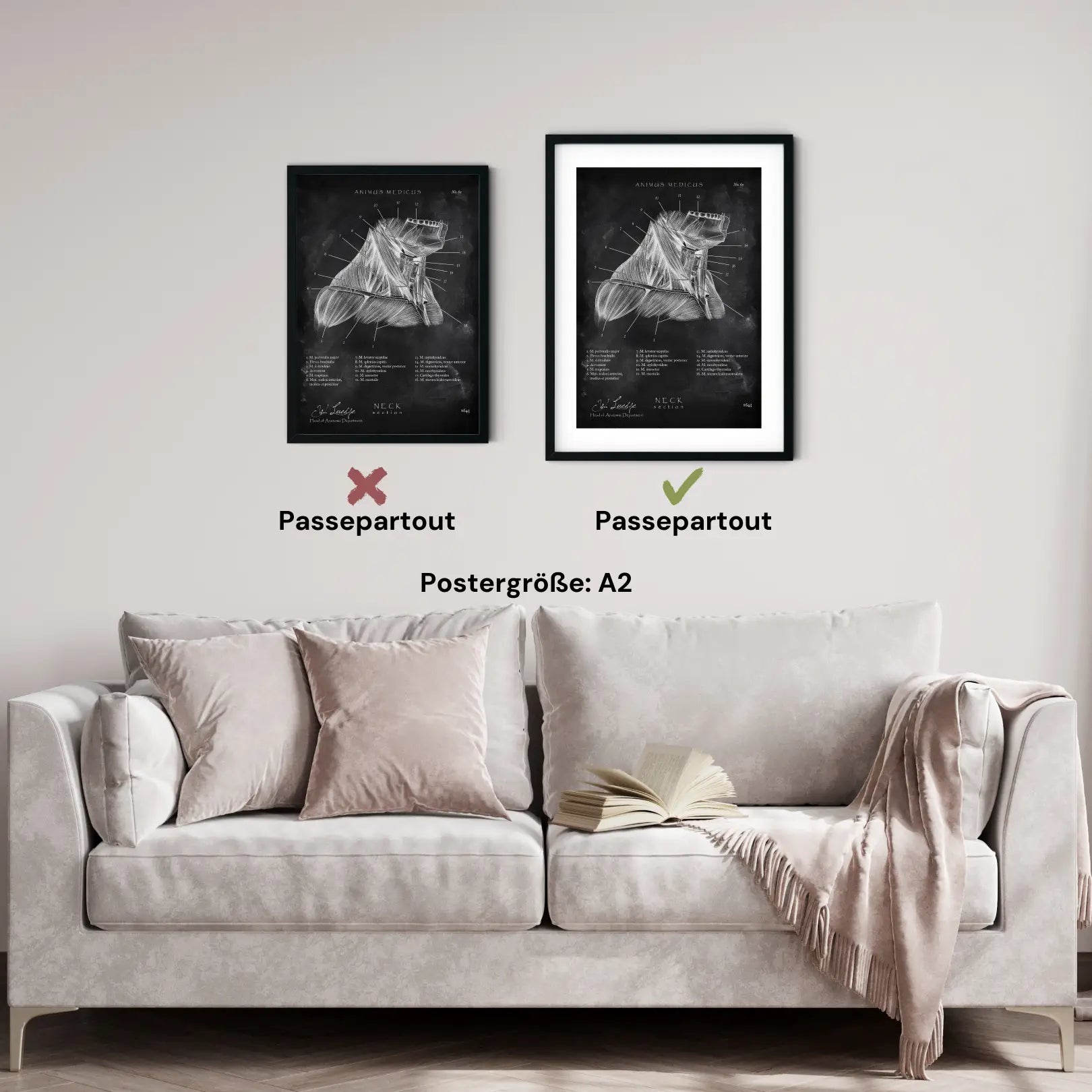 Halsmuskeln im Schnitt - Chalkboard - Animus Medicus GmbH