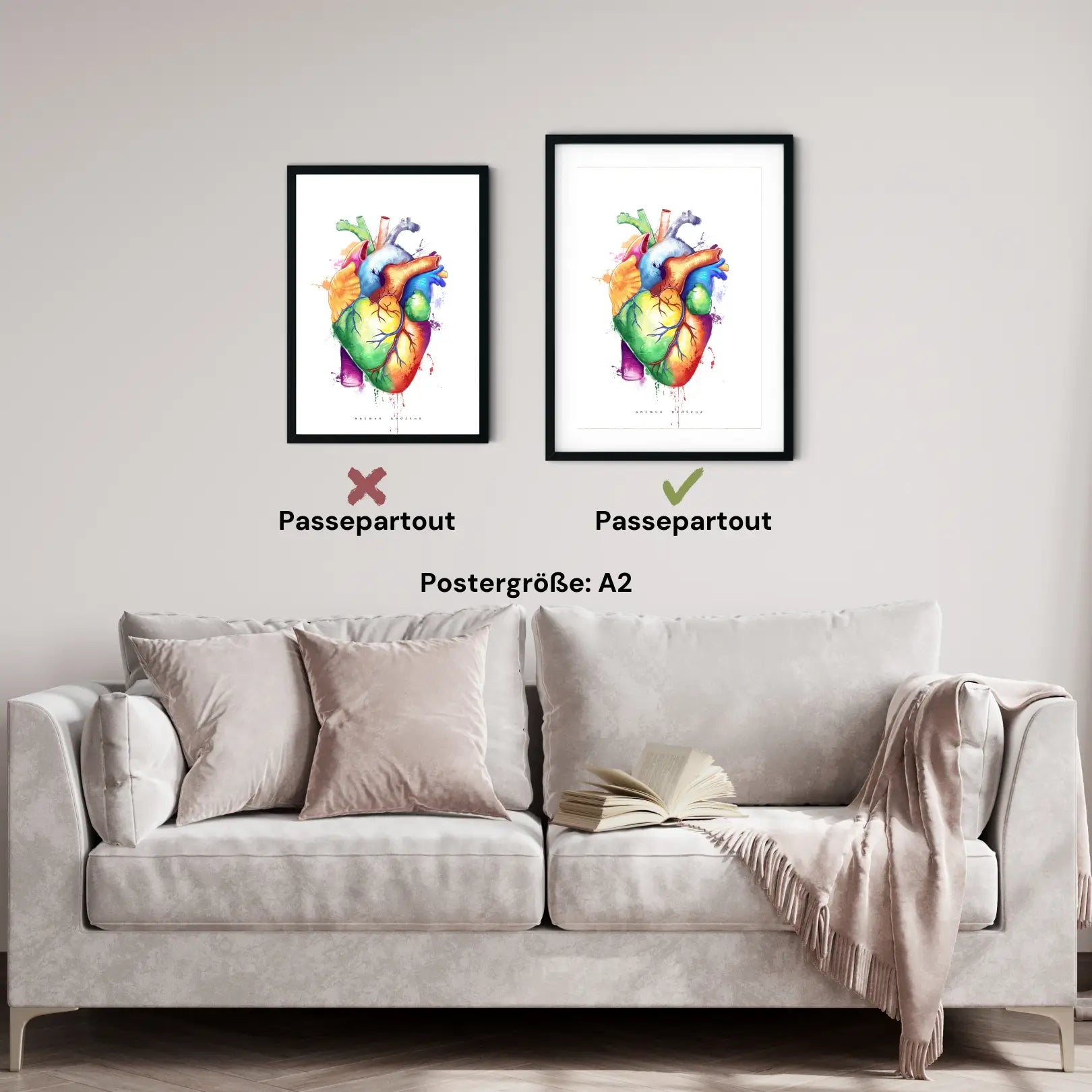 Herz Anatomie - Rainbow - Animus Medicus GmbH