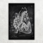 Herz im Schnitt - Chalkboard - Animus Medicus GmbH
