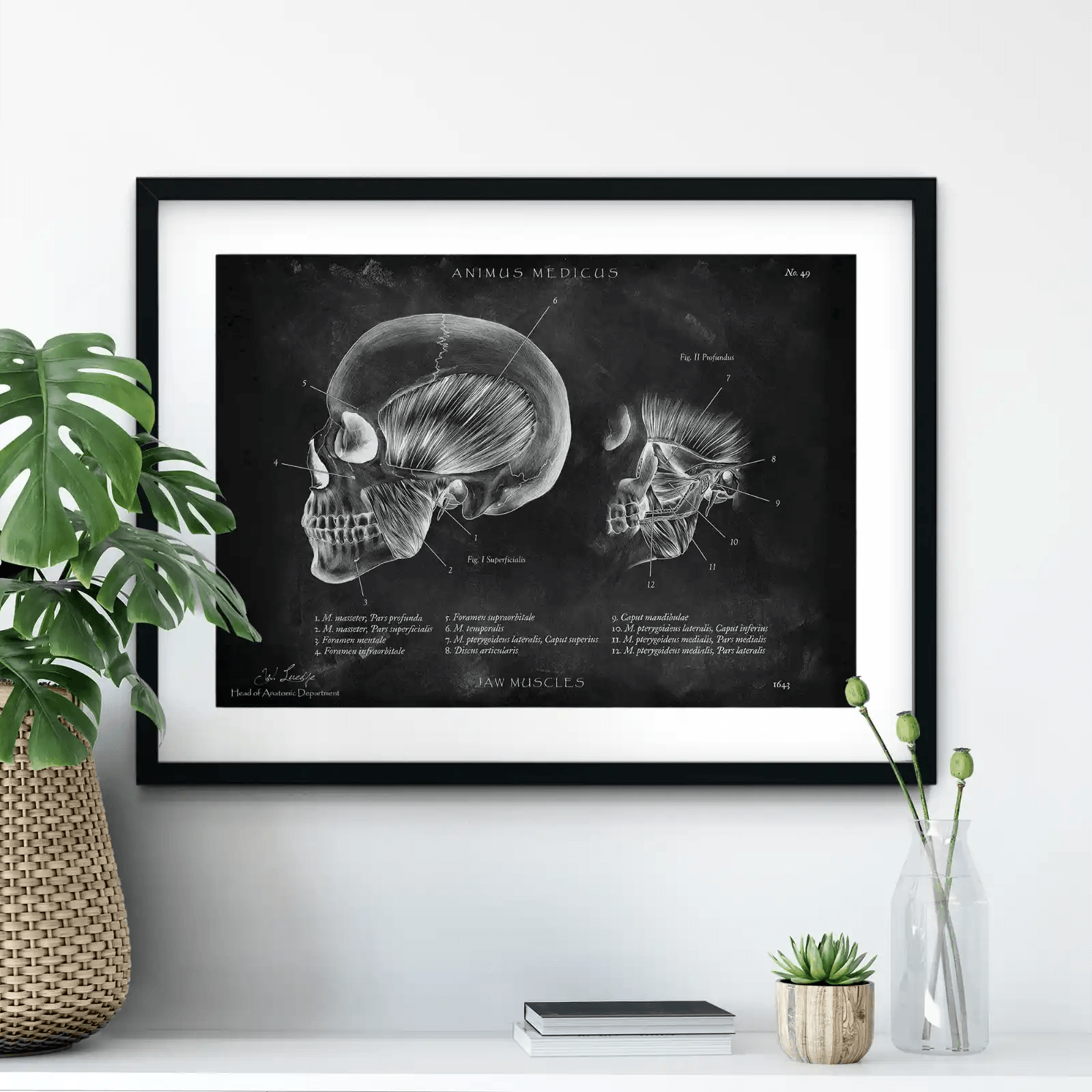 Kaumuskulatur Anatomie - Chalkboard - Animus Medicus GmbH
