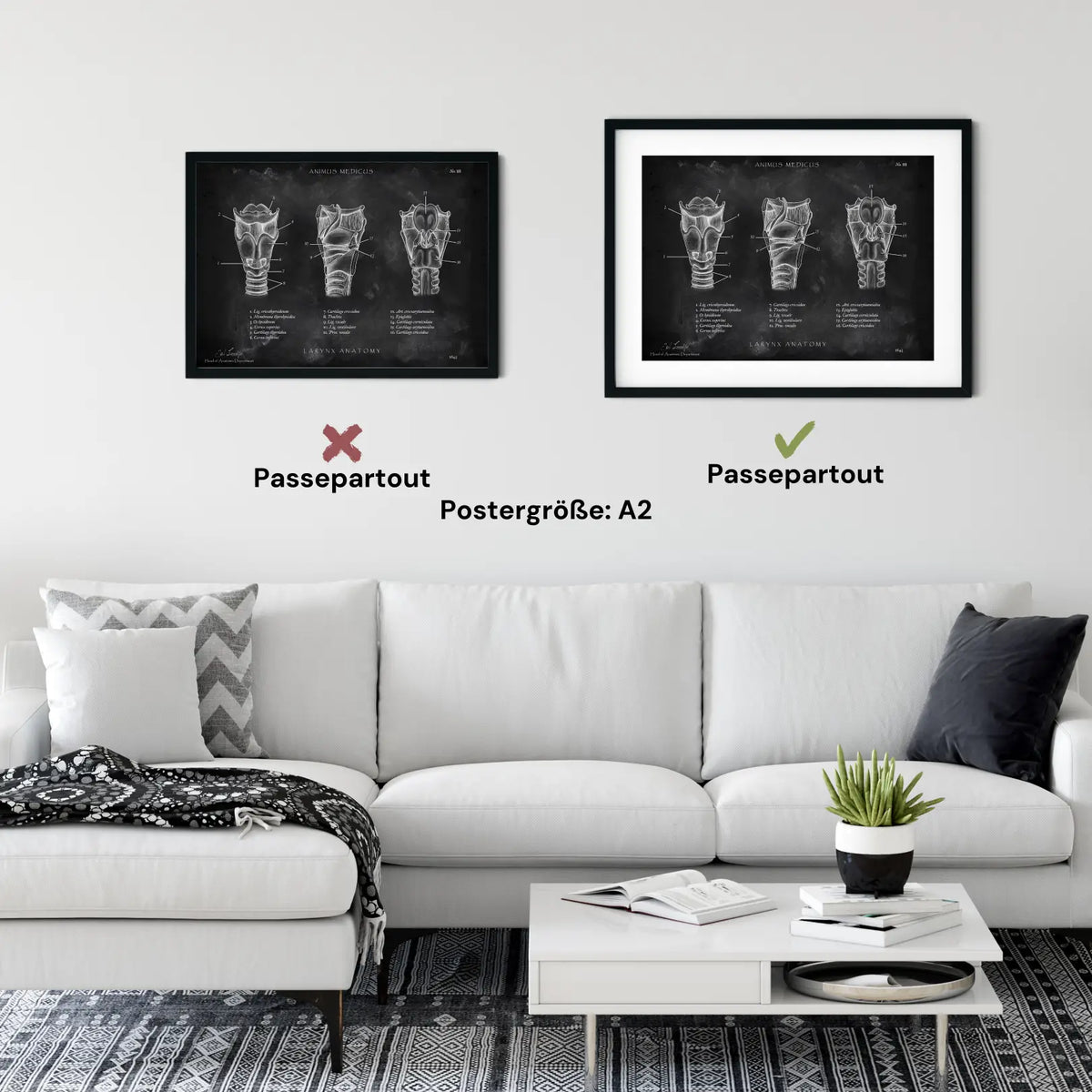 Kehlkopf Anatomie - Chalkboard - Animus Medicus GmbH