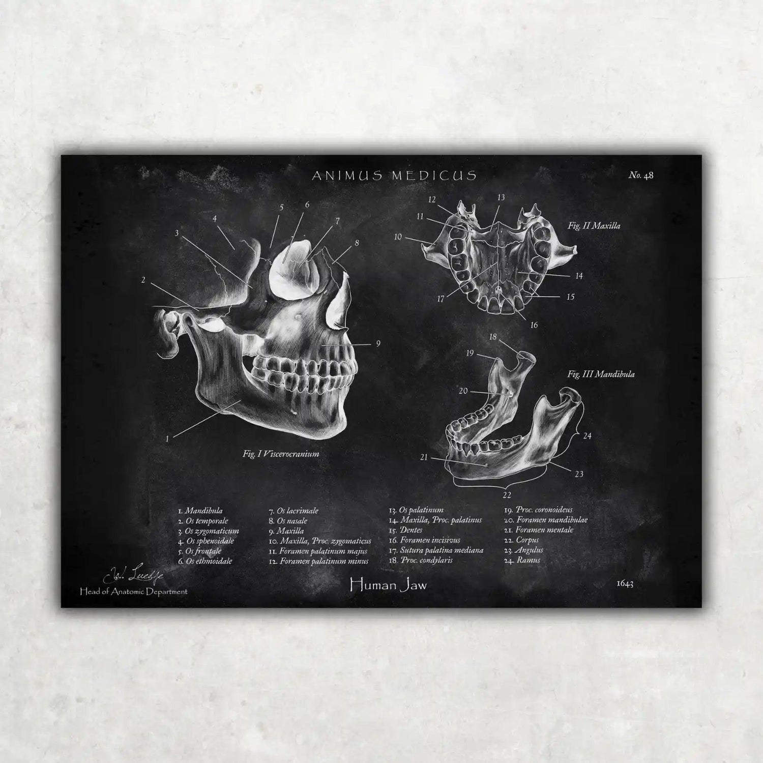 Kiefergelenk Anatomie - Chalkboard - Animus Medicus GmbH