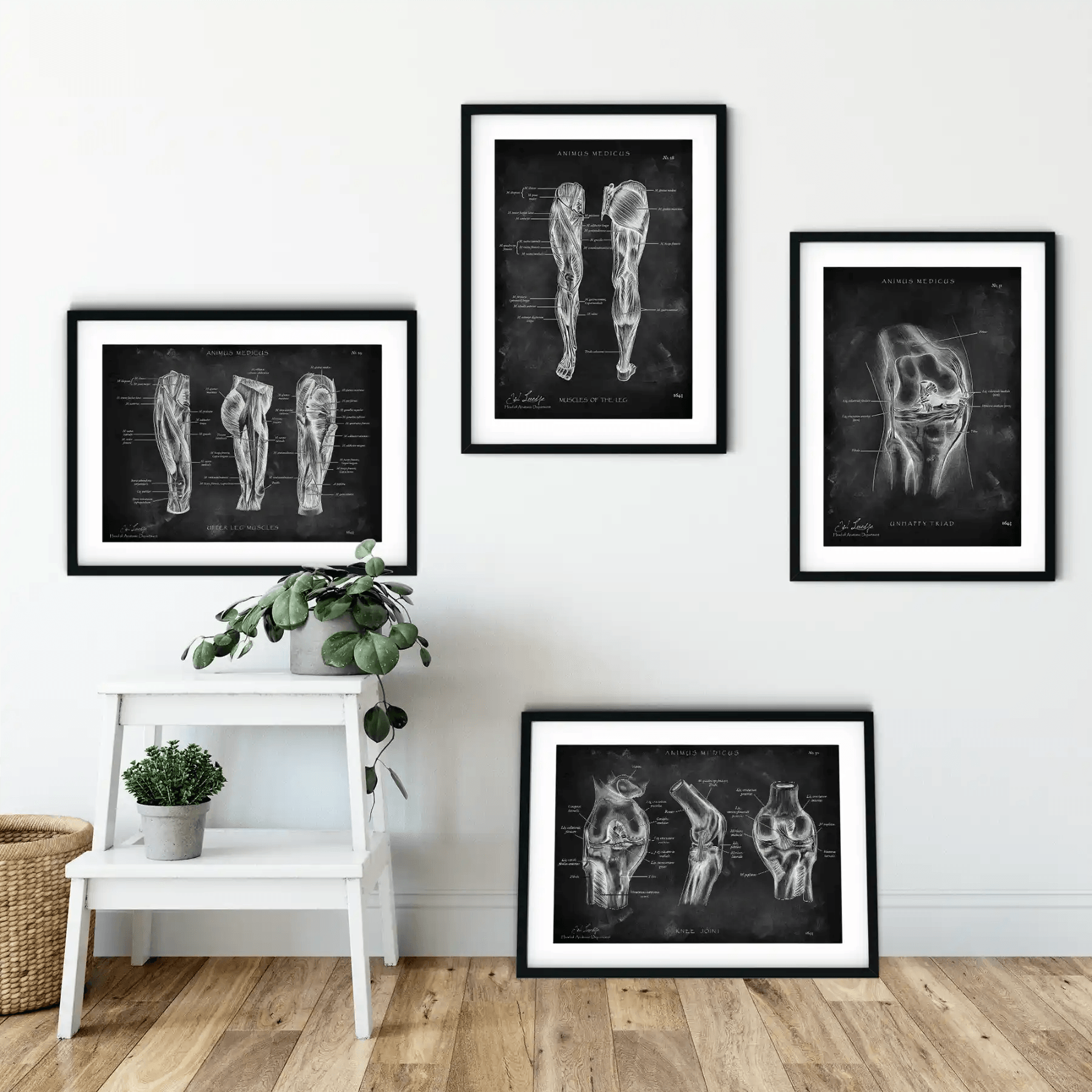 Knie Anatomie Sammlung - Chalkboard - Animus Medicus GmbH