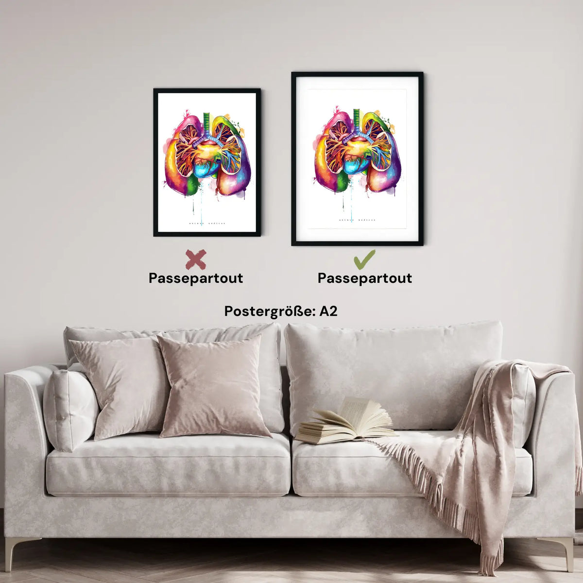 Lungen Anatomie - Rainbow - Animus Medicus GmbH